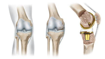 The-shoulder-joint_3
