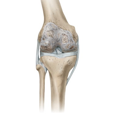 The-shoulder-joint_1