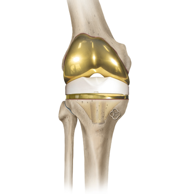 The-shoulder-joint_2